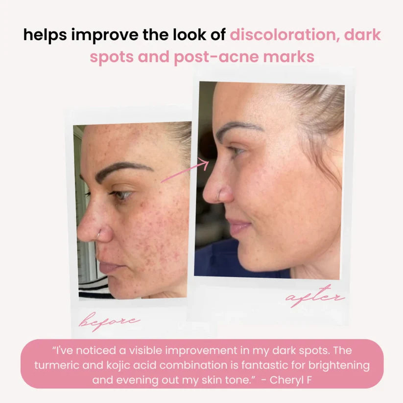 Turmeric Kojic Acid Pads