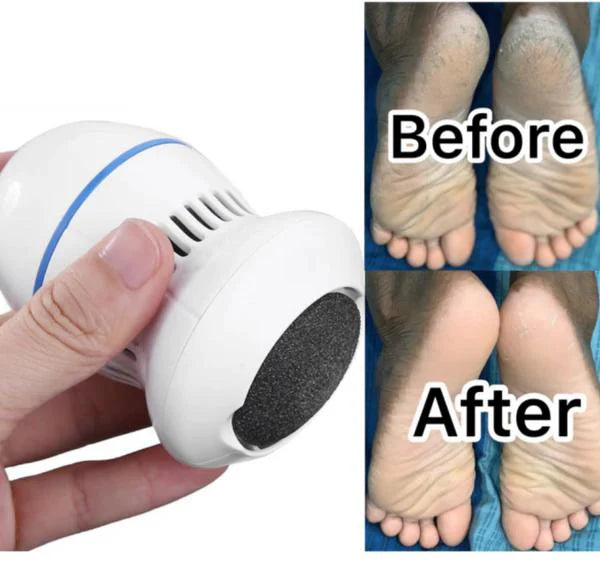 The NEW Rechargeable Electric Vacuum Foot Cleaner 20% OFF